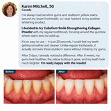 Smile Strengthening Collagen Powder